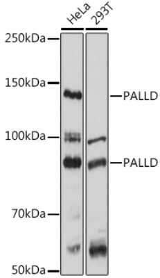 Western Blot: Palladin AntibodyAzide and BSA Free [NBP2-93983]
